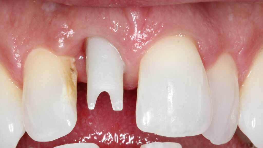 Bublik Dental staff Wausau WI