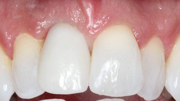 Bublik Dental team Wausau WI